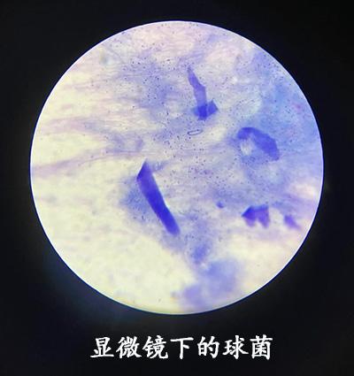 如何有效治疗与预防狗狗球菌感染皮肤病？