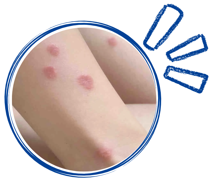 猫尾巴上得了猫癣怎么办？别急，治疗方法很简单