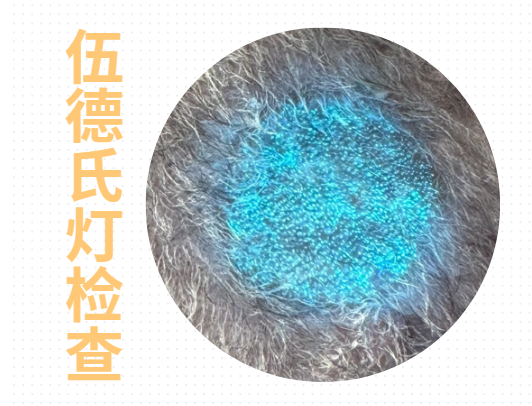 猫耳朵长猫癣了用什么药好？